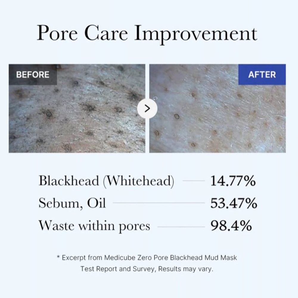 NEW medicube Zero Pore Blackhead Mud Mask - Picture 5 of 9